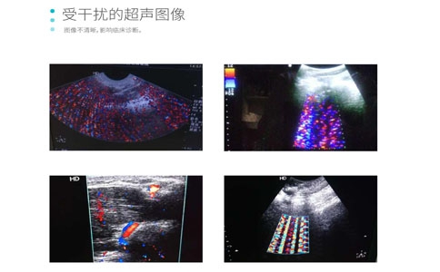 影像干擾解決方案